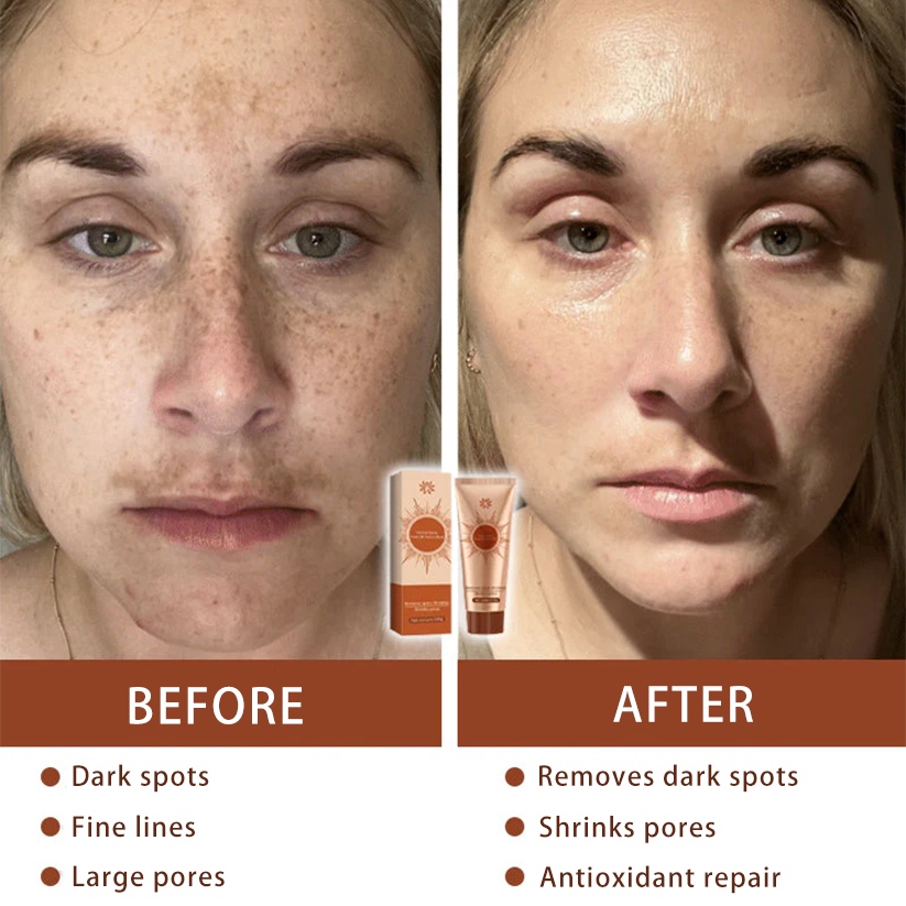 Herbal acne peeling mask