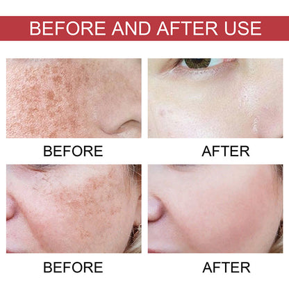 VitaGlow Hoygi Serum