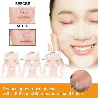 The nose acne patch