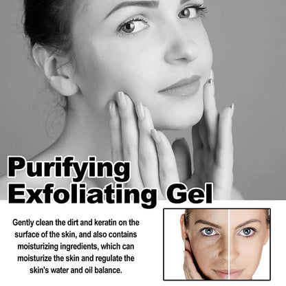 Exfoliating gel