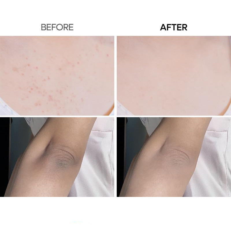 Exfoliating Essence Spray