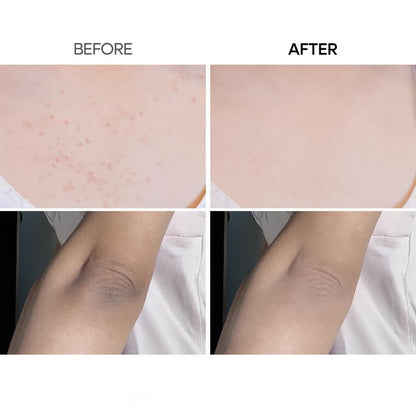Exfoliating Essence Spray