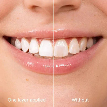 Gentle dental care paint