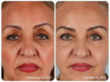 AUQUEST™ INSTANT AGELESS CREAM